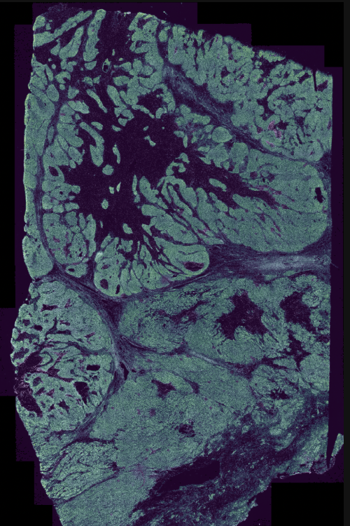 Human Ovary FF